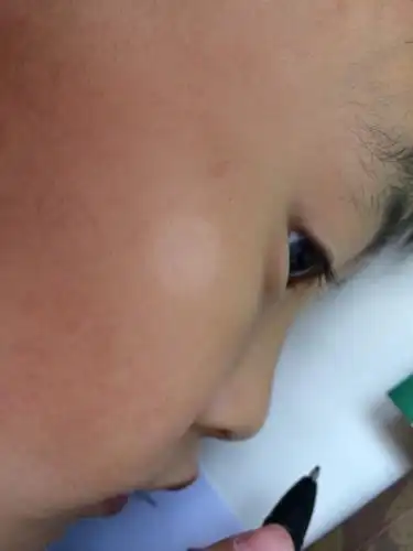 白色胎记:很多新生儿出生之后身上都会有白色胎记,形状也是不规则的