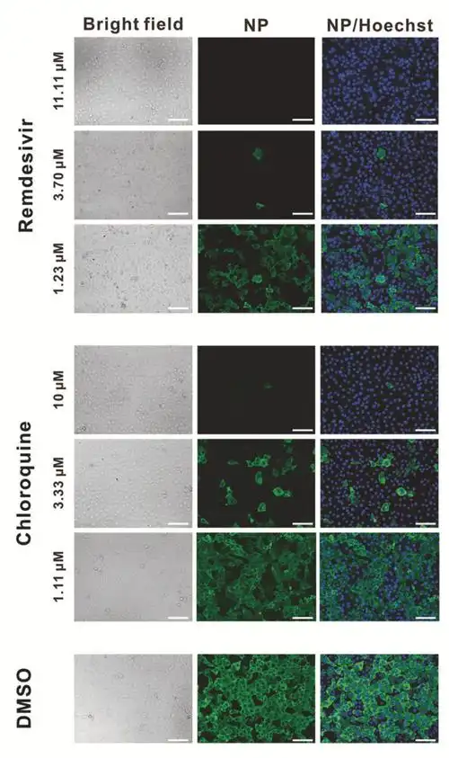 免疫荧光显微镜下看到的抑制病毒效果