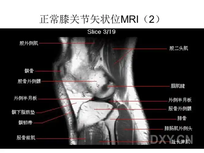 膝关节mri解剖ppt课件