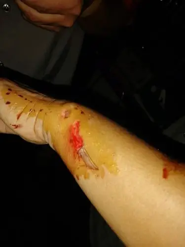 胡同管家保安见义勇为,传递正能量