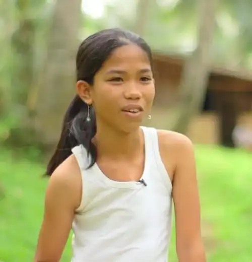 14岁少女胸部长出两只手需要定期剪指甲