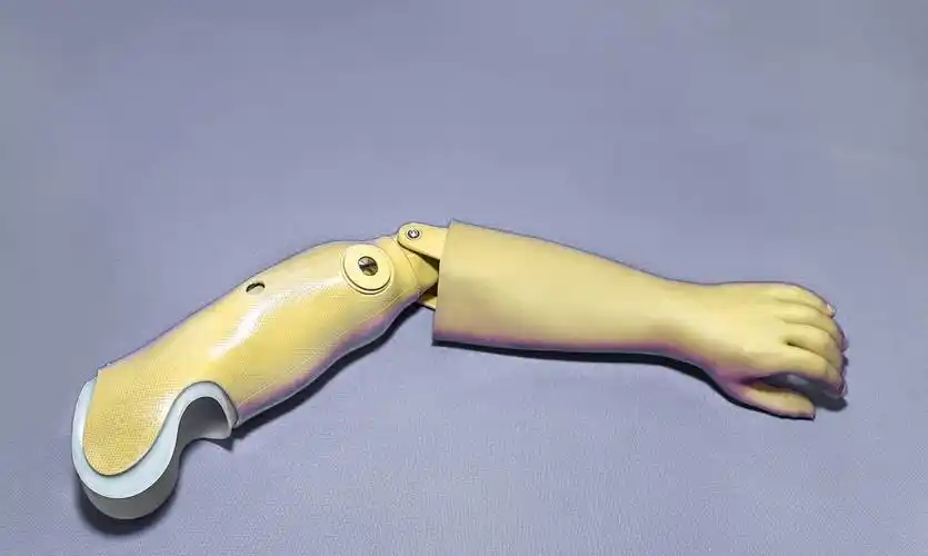 前臂假肢挑选的关键点有哪些