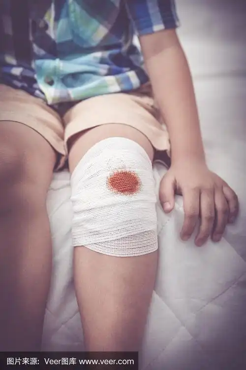 孩子受伤.孩子膝盖上的伤口用绷带包扎.复古的基调.