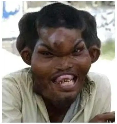 长着恐怖"魔鬼面孔"的男子.