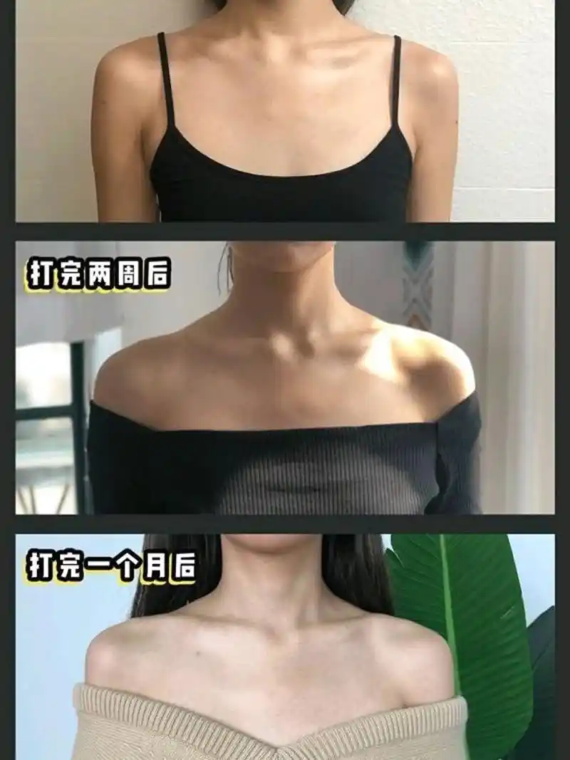 但是,虽然瘦肩针可以实现暂时的美容效果,但是它的危害是不可忽视的.