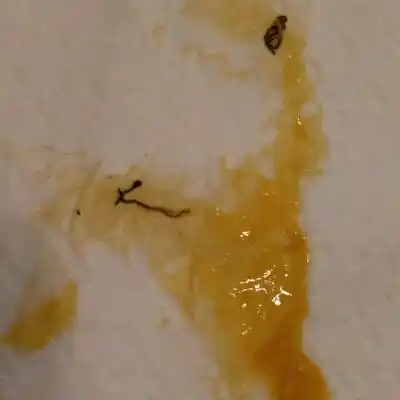 三个月的婴儿大便有线状黑细条,像虫子样,不知是什麼?