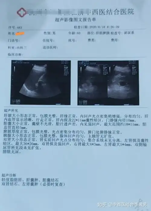 治疗胆结石案例一则