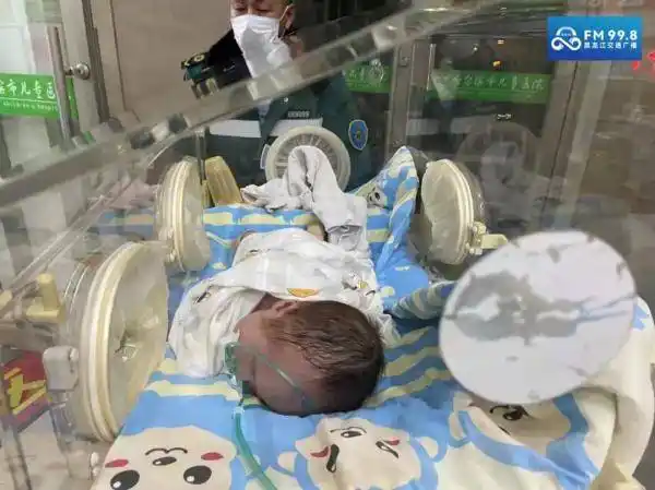 早产女婴患先天性心脏病伴有心衰肺动脉高压病情严重