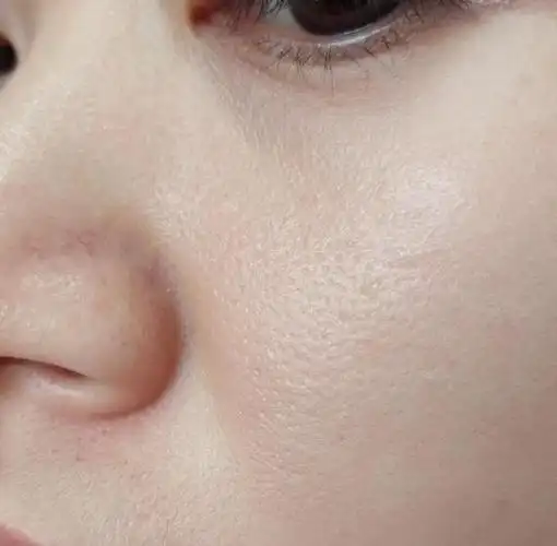 脸上毛孔粗大有什么方法修复?这几个小技巧,简单在家就能做!