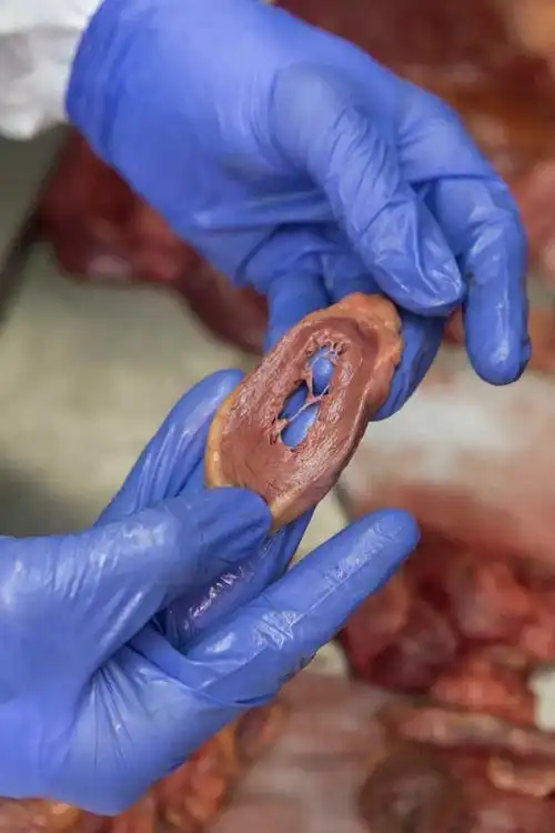 真实的尸检是怎样进行的?