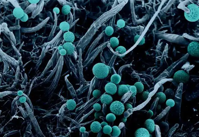 比新冠更可怕无药可医的神秘疾病再次侵袭印度患者会长肉芽