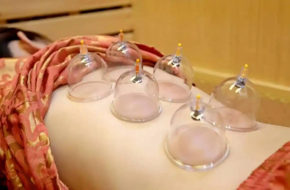 拔火罐时后背吸出来的瘀血真的是毒素吗医生告诉你实话