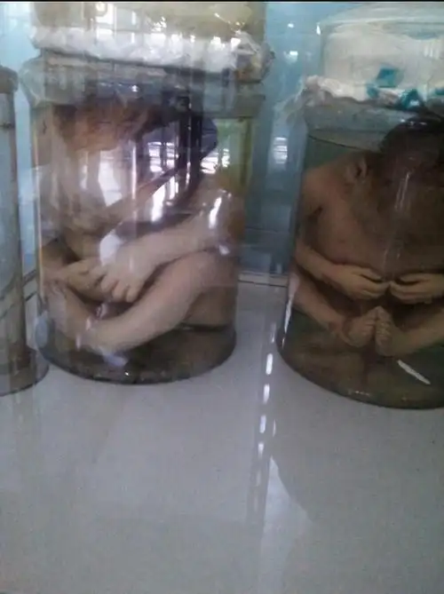 学校实验室怎么会有死去的婴儿装在瓶子里犯法吗?