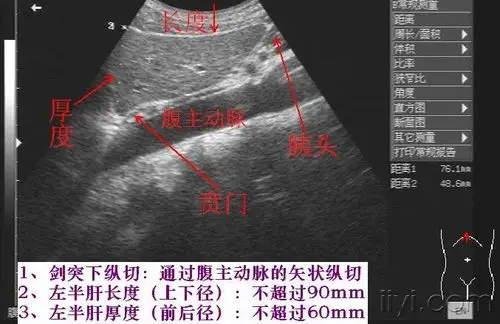 肝脏实习内容图片集
