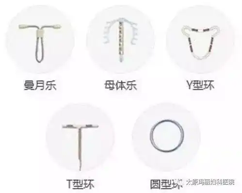 避孕环种类多 要如何选? 曼月乐:适合有过环下移脱落史,宫腔较大者.