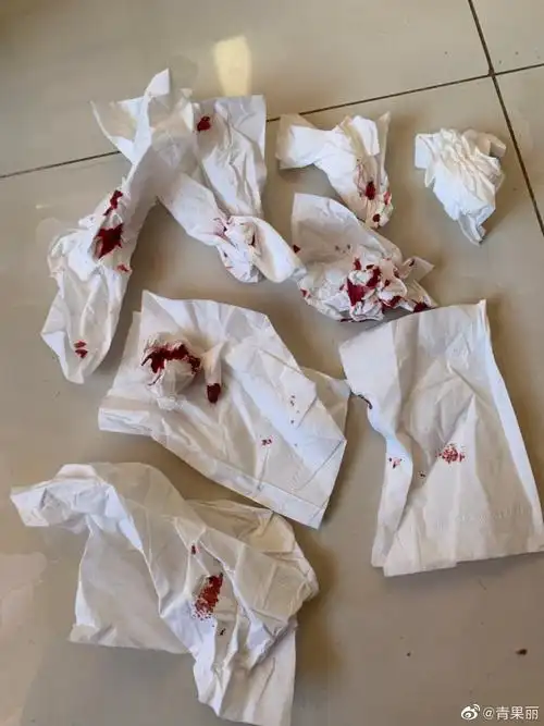 图三是擦鼻血用过的纸