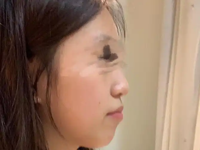 家人们 我这是地包天还是嘴突呀