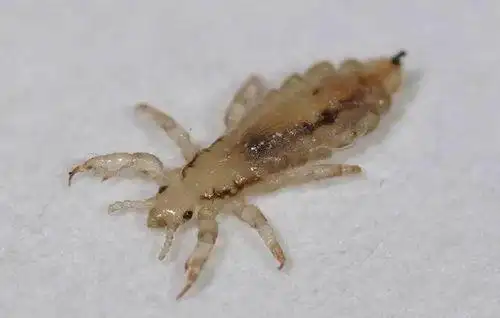 头发上的虱子图片高清 - 搜狗图片搜索