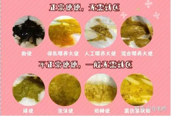 宝宝正常的大便什么样