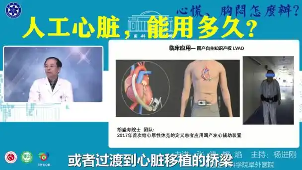 人工心脏,能用多久?