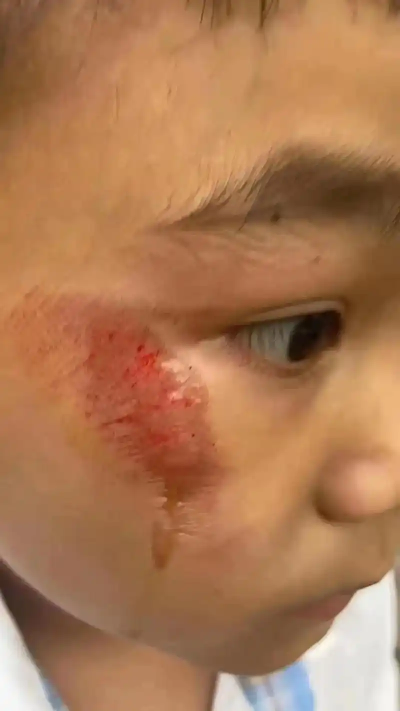 脸上破了怎么恢复得快 - 抖音