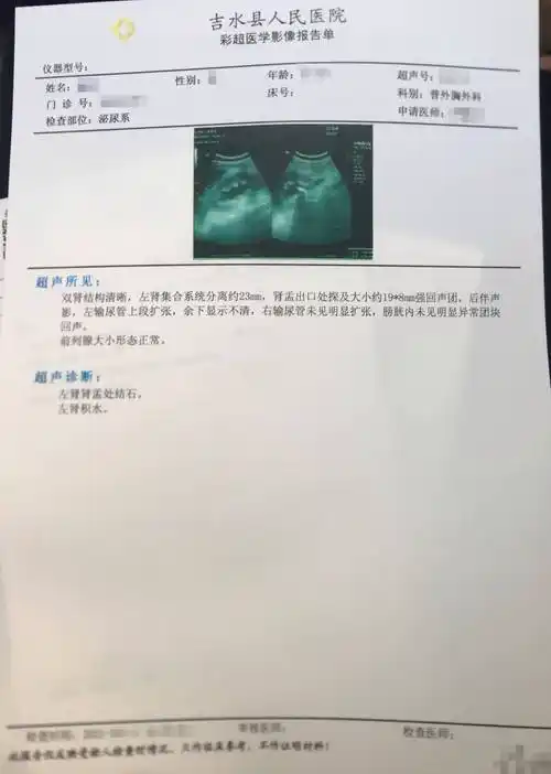 杨佩医师治泌尿系结石一例