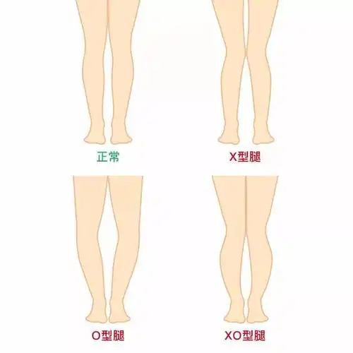 xo型腿改善1脊椎动态稳定与下肢发力次序重建及强化