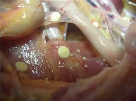 女性霉菌感染严重吗?女性霉菌是怎么感染的?_第二人生