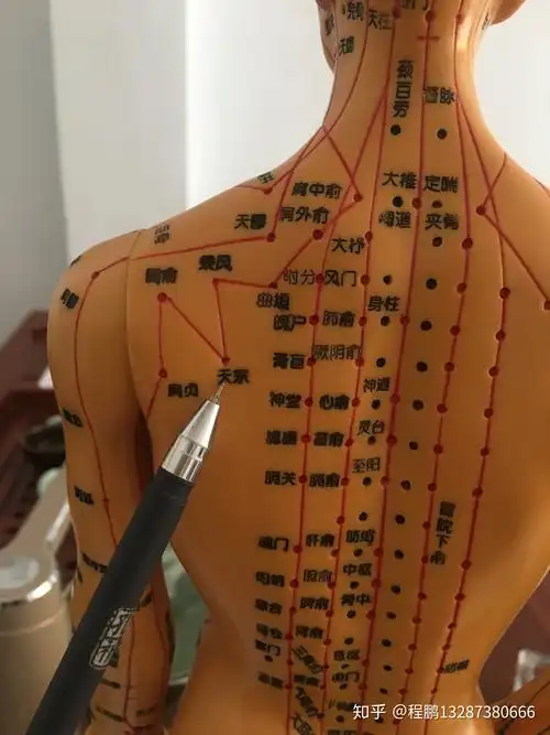 拔罐调理病症之乳腺增生