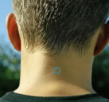 昂起脖子后用手能摸到后面有一块凸起的东西,像是一块翘起的小骨头