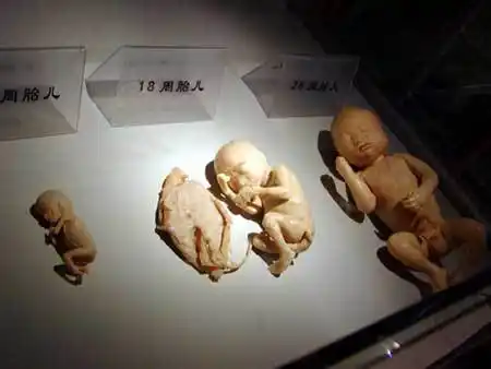 图文:婴儿标本——很像塑料娃娃