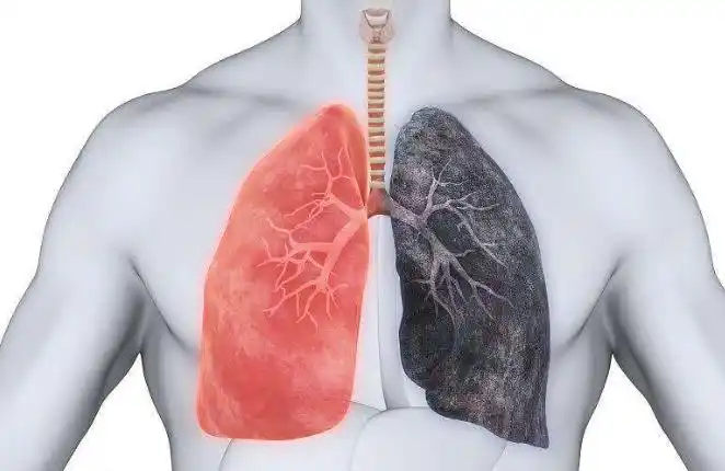 肺部"清洁剂"找到了,不是冰糖雪梨,你若爱喝,给肺部来场大扫除!