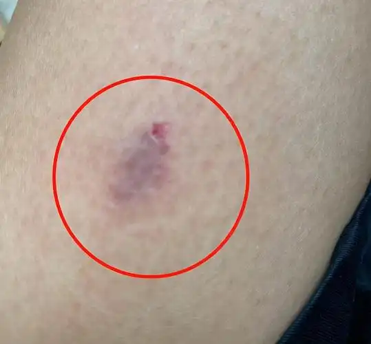 蔡少芬被狗咬破皮狗狗主人在线求原谅她的回复尽显真人脾性