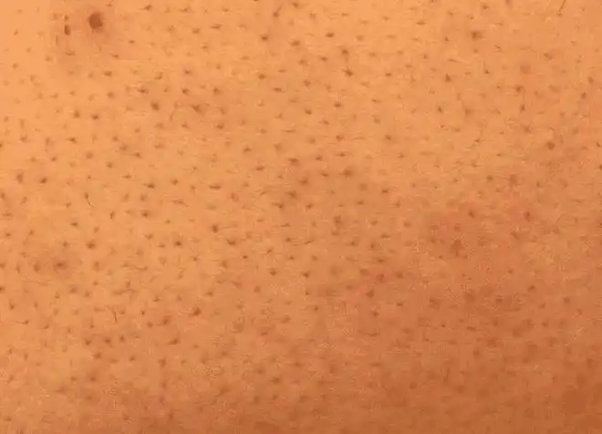 后背出现这个4个异常是螨虫在向你说哈喽啊