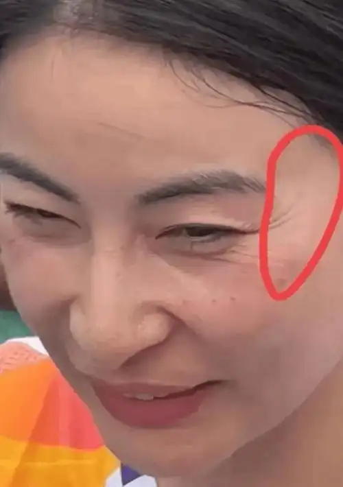 41岁郭晶晶因鱼尾纹上热搜?网友好奇为何不医美?_什么_女人_阴德