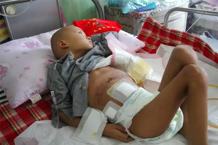 17年夏天,好动的小博瀚经常喊累,没几天时间又开始呕吐,肚子疼,还总是