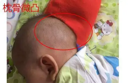 枕骨微凸第四种,眉骨伏犀起,不粗,不露,隐伏,圆起,有威权,性刚勇,二十