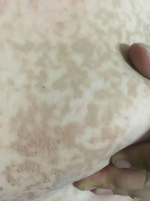 脖子上和胸前有大片的黑斑