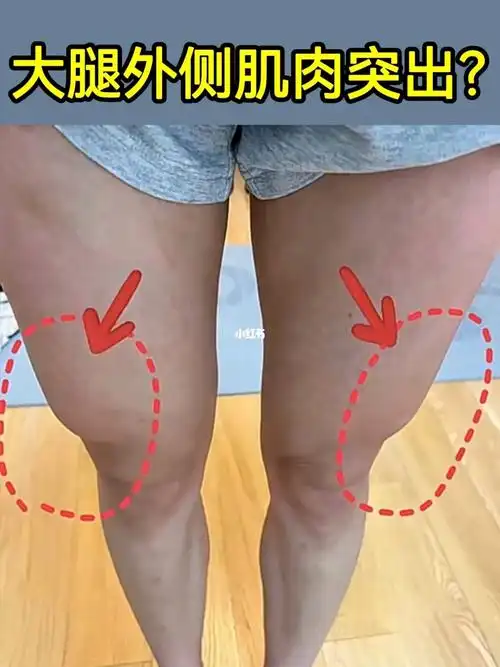 改善大腿两侧肌肉外翻71yyds