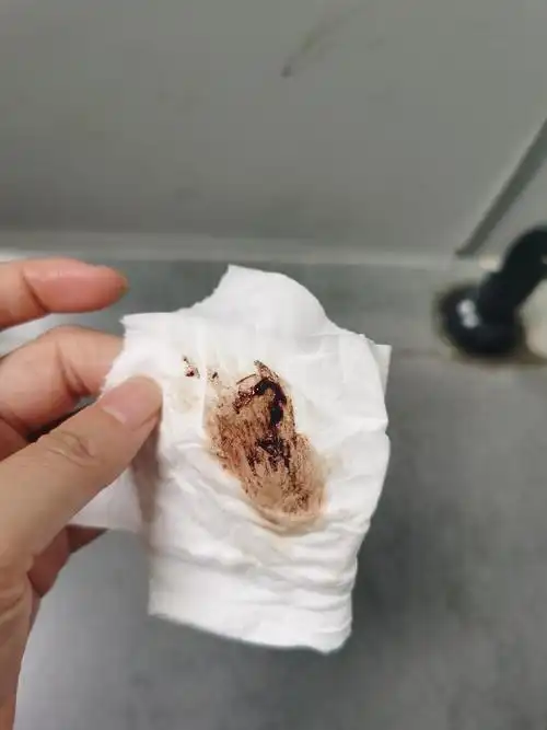 大姨妈前两天有褐色分泌物,快结束的时候有黑色残留物,经期长,有实图