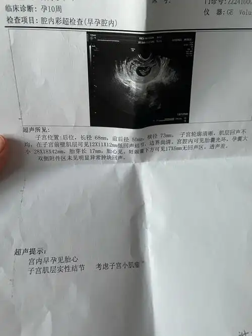 巧囊术后五个月意外怀孕了等两周做nt了