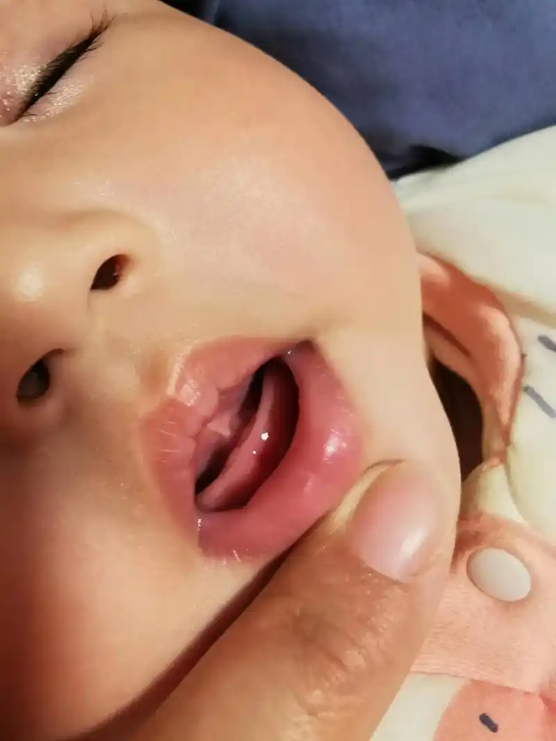 长牙啦.宝宝的第一颗乳牙已冒出,姑姑安排的鞋子已到位.接下来 - 抖音