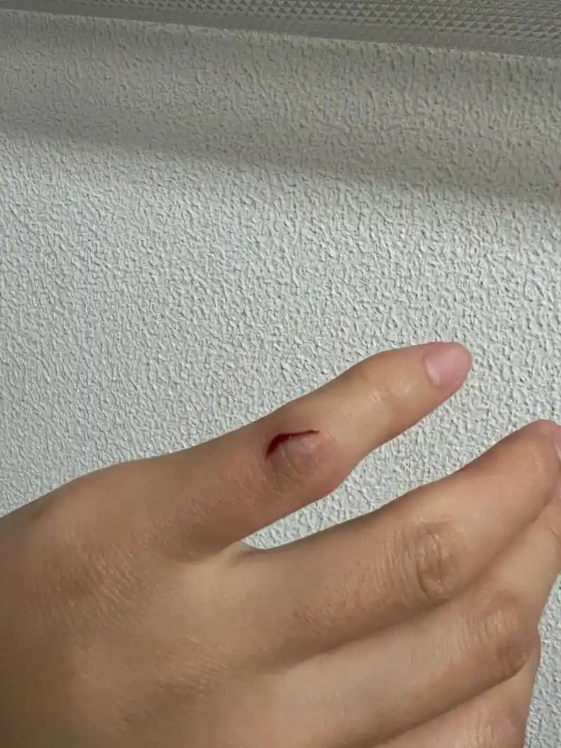 刀把自己的手划了一个很深的口子,刚划的时候还在想可真深,怎么不流血