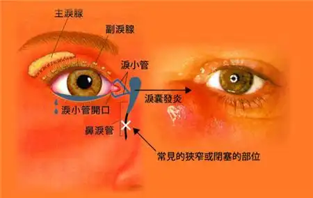 昆明治疗泪道病比较好的眼科医院