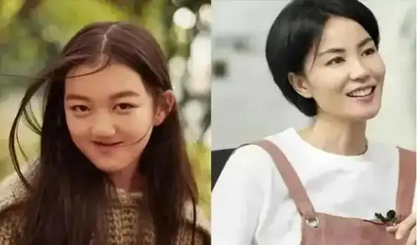 最后一次修复手术完成!18岁李嫣晒素颜照,嘴好了,脸却越发奇怪