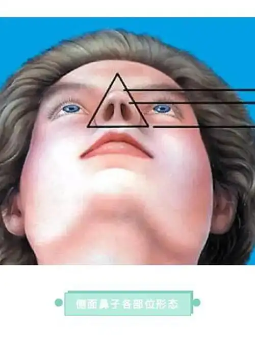 鼻尖的调整和垫高一直是隆鼻手术中的重点及难点调整得_圈子-新氧美容