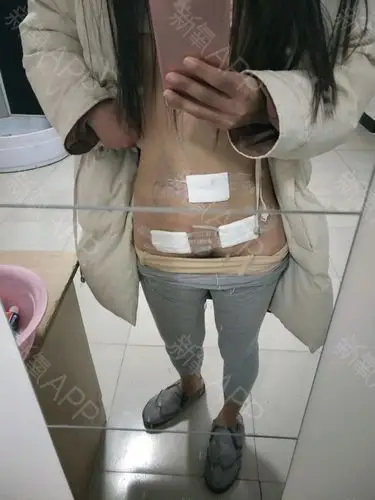 今天感觉没有那么疼了