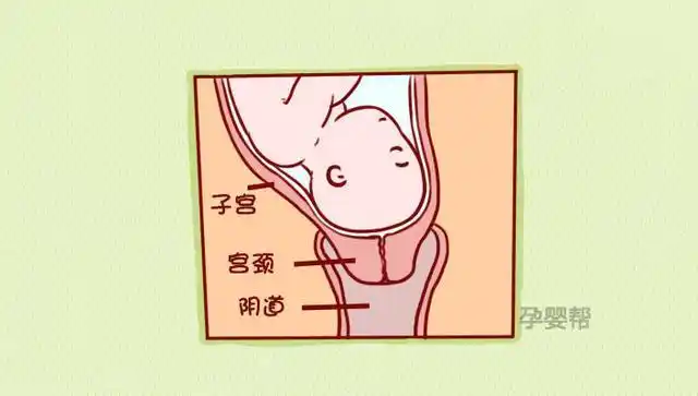 关于开宫口,临产前你必须知道