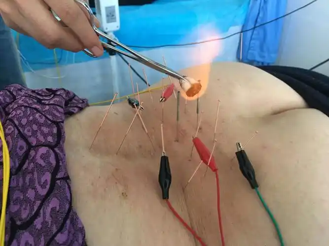 鄂前旗人民医院中蒙医科"数字医学" "传统医学"治未病.