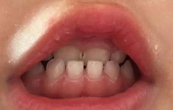 3,给宝宝使用奶嘴:奶嘴在一定程度确实可以起到安抚宝宝情绪的作用